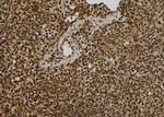 eIF3a Antibody in Immunohistochemistry (Paraffin) (IHC (P))