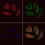 Fibulin 1 Antibody in Immunocytochemistry (ICC/IF)