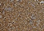 QSER1 Antibody in Immunohistochemistry (Paraffin) (IHC (P))