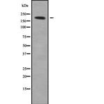 QSER1 Antibody in Western Blot (WB)