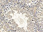 GCH1 Antibody in Immunohistochemistry (Paraffin) (IHC (P))