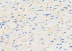 SAR1A Antibody in Immunohistochemistry (Paraffin) (IHC (P))