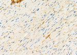 SAR1A Antibody in Immunohistochemistry (Paraffin) (IHC (P))