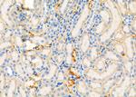 SAR1A Antibody in Immunohistochemistry (Paraffin) (IHC (P))