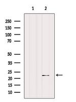 SAR1A Antibody in Western Blot (WB)