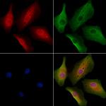 RABIF Antibody in Immunocytochemistry (ICC/IF)