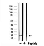 RABIF Antibody in Western Blot (WB)