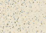 HOXB3 Antibody in Immunohistochemistry (Paraffin) (IHC (P))