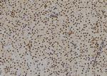 SIX3 Antibody in Immunohistochemistry (Paraffin) (IHC (P))