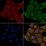 KIR2DS5 Antibody in Immunocytochemistry (ICC/IF)