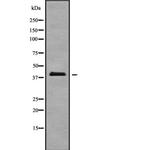 A4GALT Antibody in Western Blot (WB)