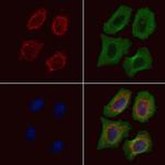 CD85j (ILT2) Antibody in Immunocytochemistry (ICC/IF)