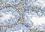 MED29 Antibody in Immunohistochemistry (Paraffin) (IHC (P))