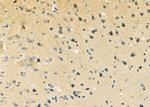 SLC16A6 Antibody in Immunohistochemistry (Paraffin) (IHC (P))