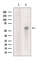 SLC16A6 Antibody in Western Blot (WB)