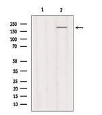 MYH3 Antibody in Western Blot (WB)