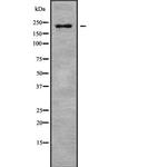 MYH8 Antibody in Western Blot (WB)