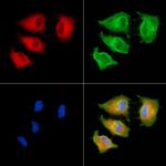 MYO3B Antibody in Immunocytochemistry (ICC/IF)