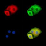 MYO3B Antibody in Immunocytochemistry (ICC/IF)