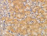 MYO3B Antibody in Immunohistochemistry (Paraffin) (IHC (P))