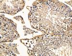 MYO3B Antibody in Immunohistochemistry (Paraffin) (IHC (P))