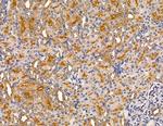 MYO3B Antibody in Immunohistochemistry (Paraffin) (IHC (P))