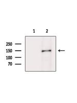 MYO3B Antibody in Western Blot (WB)