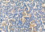 MYO5C Antibody in Immunohistochemistry (Paraffin) (IHC (P))