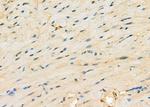 MYO5C Antibody in Immunohistochemistry (Paraffin) (IHC (P))