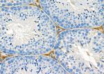 MYO5C Antibody in Immunohistochemistry (Paraffin) (IHC (P))