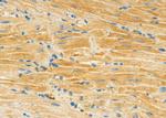 MYO6 Antibody in Immunohistochemistry (Paraffin) (IHC (P))