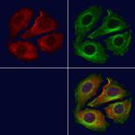 NNT Antibody in Immunocytochemistry (ICC/IF)