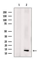 NDUFA5 Antibody in Western Blot (WB)