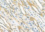 NDUFC1 Antibody in Immunohistochemistry (Paraffin) (IHC (P))