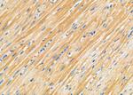 NDUFC1 Antibody in Immunohistochemistry (Paraffin) (IHC (P))