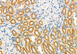 NDUFC1 Antibody in Immunohistochemistry (Paraffin) (IHC (P))