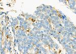 NDUFC1 Antibody in Immunohistochemistry (Paraffin) (IHC (P))