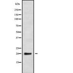 NDUFS4 Antibody in Western Blot (WB)