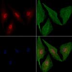 NAV2 Antibody in Immunocytochemistry (ICC/IF)