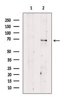 CHRNB4 Antibody in Western Blot (WB)