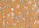 GPM6B Antibody in Immunohistochemistry (Paraffin) (IHC (P))