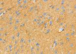 GPM6B Antibody in Immunohistochemistry (Paraffin) (IHC (P))