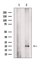 GPM6B Antibody in Western Blot (WB)