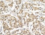 NUP205 Antibody in Immunohistochemistry (Paraffin) (IHC (P))