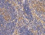 NUP205 Antibody in Immunohistochemistry (Paraffin) (IHC (P))