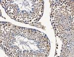 NUP205 Antibody in Immunohistochemistry (Paraffin) (IHC (P))