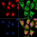 TNP2 Antibody in Immunocytochemistry (ICC/IF)