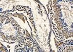 TNP2 Antibody in Immunohistochemistry (Paraffin) (IHC (P))