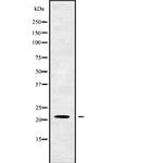 OAZ2 Antibody in Western Blot (WB)