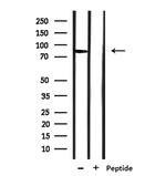 SLC6A17 Antibody in Western Blot (WB)